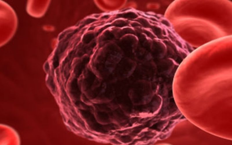 A Pozzallo, un corso di formazione sul Microcircolo Cutaneo