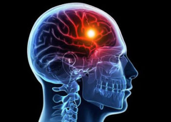 Asp di Ragusa: campagna di sensibilizzazione sull’Ictus