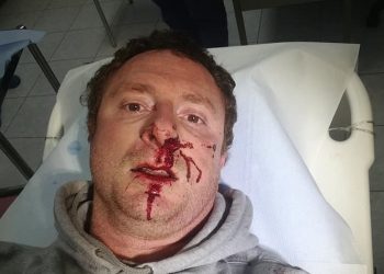 Imprenditore del vino di Chiaramonte picchiato selvaggiamente da sei motociclisti