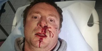 Imprenditore del vino di Chiaramonte picchiato selvaggiamente da sei motociclisti