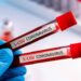 Coronavirus: aumentano i guariti in provincia di Ragusa, ma purtroppo c’è un’altra vittima