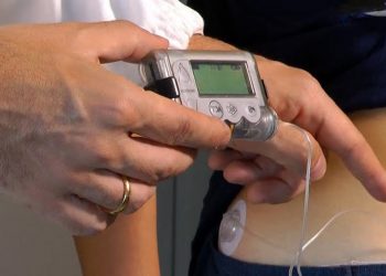 Aggiudicata all’Asp di Ragusa la gara per l’erogazione di microinfusori per bambini affetti da Diabete di tipo 1