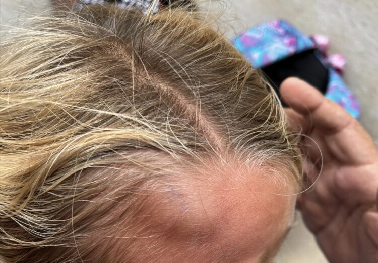 Comiso, cade calcinaccio e ferisce una bimba all’uscita da scuola