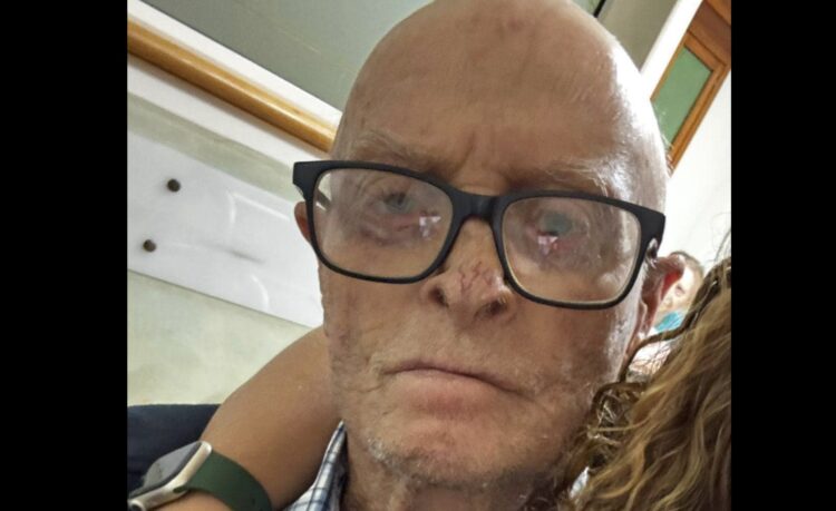 Anziano disperso a Ispica, familiari in allarme