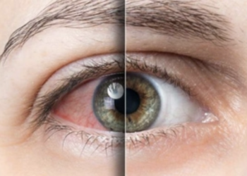 Ragusana rischia di perdere la vista, salvata con un intervento in un ospedale del Nord