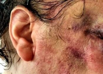 Vittoria e le aggressioni omofobe, condannato un calatino a 4 anni e 4 mesi di reclusione