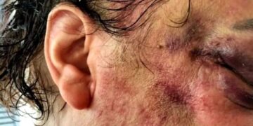 Vittoria e le aggressioni omofobe, condannato un calatino a 4 anni e 4 mesi di reclusione