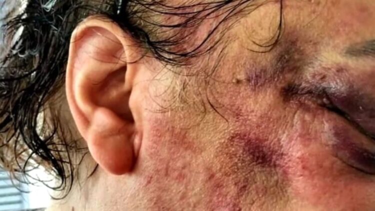 Vittoria e le aggressioni omofobe, condannato un calatino a 4 anni e 4 mesi di reclusione