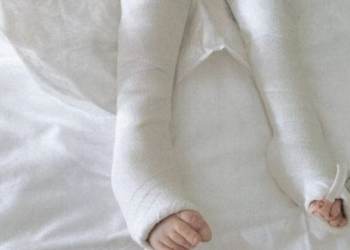 Scicli, ammesso ai domiciliari il padre del bambino con gli arti fratturati