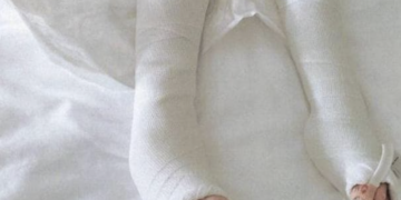 Scicli, ammesso ai domiciliari il padre del bambino con gli arti fratturati