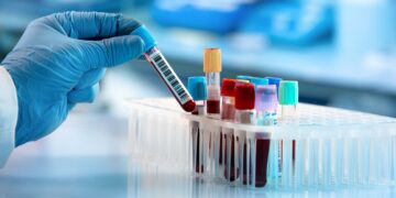 Acate, venerdì mattina l’apertura di un nuovo punto prelievi dell’Asp