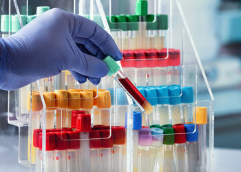 La provincia di Ragusa scippata di 369mila euro, la protesta del Movimento Laboratori Analisi