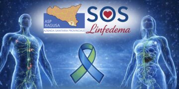 Comiso, al teatro Naselli una giornata dedicata alla conoscenza e alla cura del linfedema